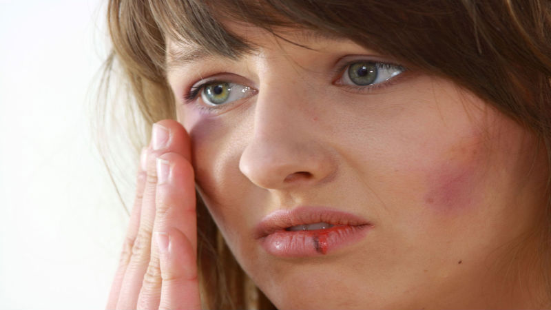 Family Lawyers in Mankato, MN Can Help You Through Your Legal Situation